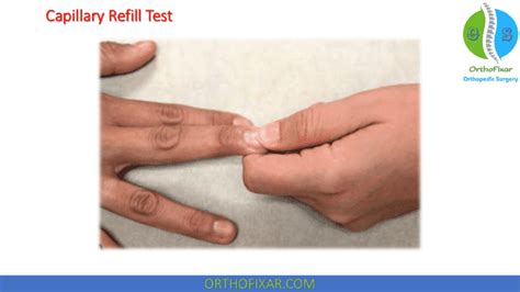 testing capillary refill on thick and yellow nail|capillary nail refill test pdf.